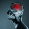 Chicago Traumatic Brain injuries (TBI) Image