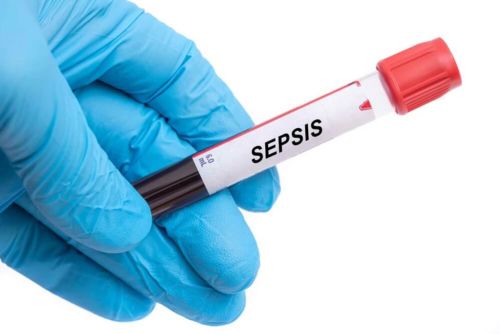 sepsis blood sample