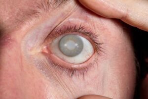 Blindness Caused by Medical Malpractice