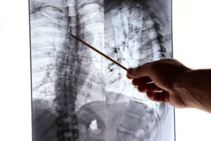 x ray interpretation errors