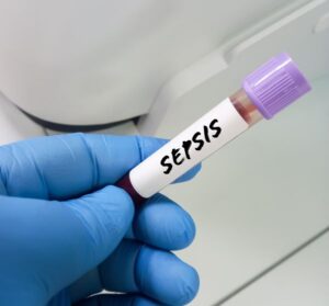 Medical Malpractice Leads to Sepsis